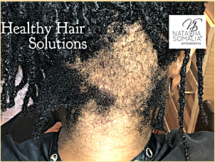 ''My hair just doesn't grow!''